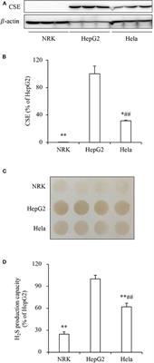 Hydrogen Sulfide Mediates Tumor Cell Resistance to Thioredoxin Inhibitor